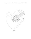 STRINGED INSTRUMENT HAND REST diagram and image