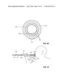 APPARATUS FOR LAUNCHING SUBCALIBER PROJECTILES AT PROPELLANT OPERATING     PRESSURES INCLUDING THE RANGE OF PRESSURES THAT MAY BE SUPPLIED BY HUMAN     BREATH diagram and image