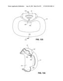 PATIENT INTERFACE SYSTEMS diagram and image