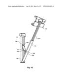 Hands Free Electronic Device Holder diagram and image