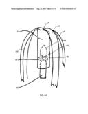 Introducer System and Assembly for Surgical Staplers diagram and image