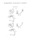 HEARING AID diagram and image