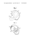 CABLE LENGTH ADJUSTMENT IN AUDITORY DEVICES diagram and image