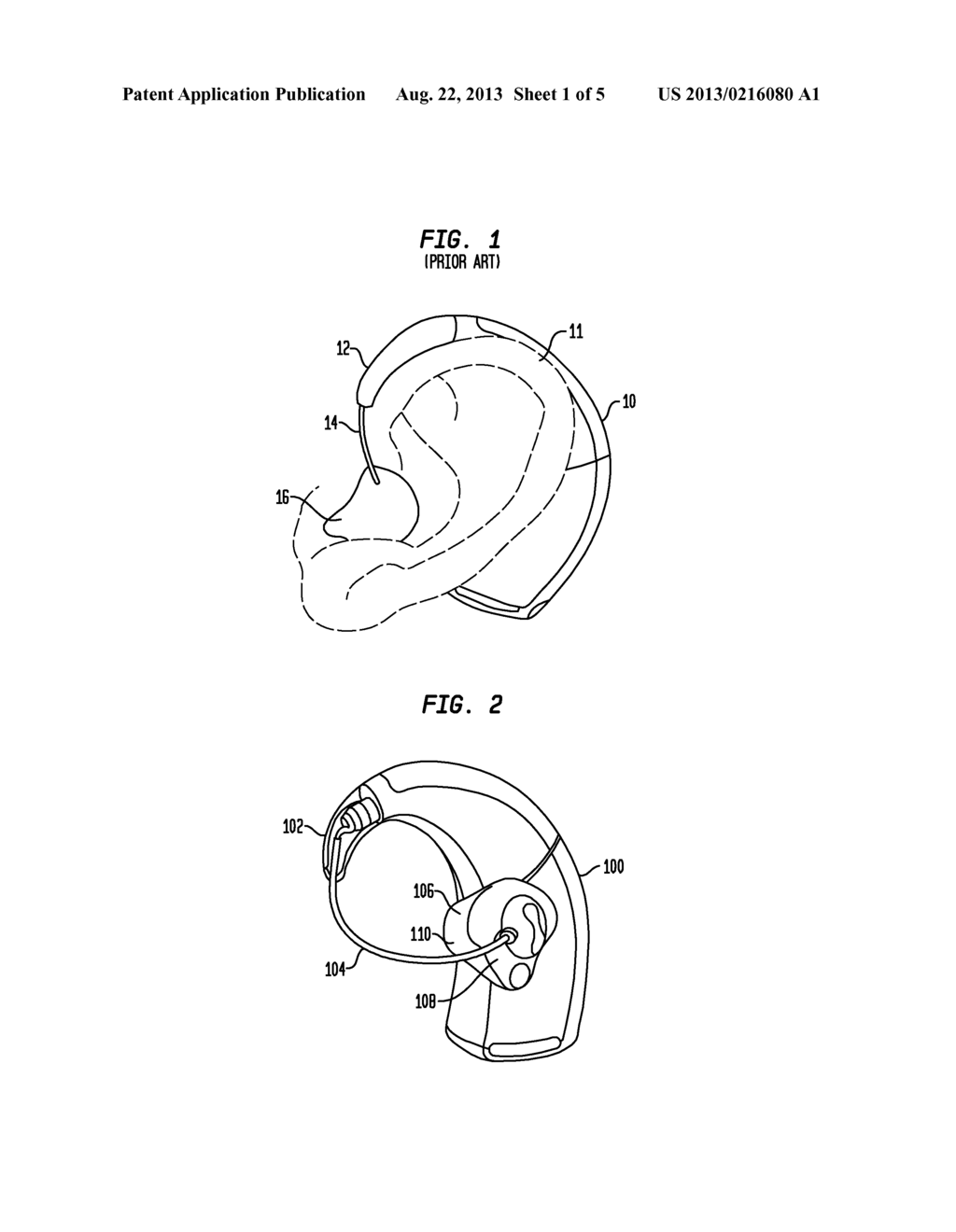 CABLE LENGTH ADJUSTMENT IN AUDITORY DEVICES - diagram, schematic, and image 02