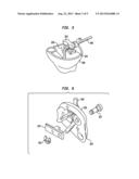 CABLE LENGTH ADJUSTMENT IN AUDITORY DEVICES diagram and image