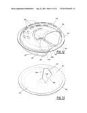 Motor Vehicle Exhaust Line diagram and image