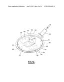 Motor Vehicle Exhaust Line diagram and image