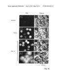 Anti-La antibodies and their use for immunotargeting diagram and image