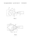 Drug-Eluting Coatings Applied to Medical Devices by Spraying and Drying to     Remove Solvent diagram and image