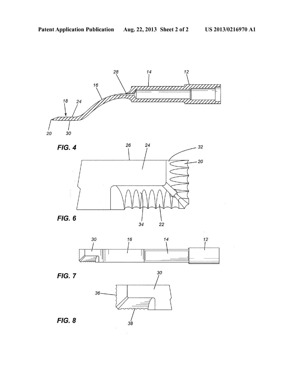 ORTHODONTIC DEBONDING TOOL, TOOL INSERT AND METHOD FOR REMOVING     ORTHODONTIC BRACKETS - diagram, schematic, and image 03