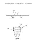 Coating for a dental matrix band diagram and image