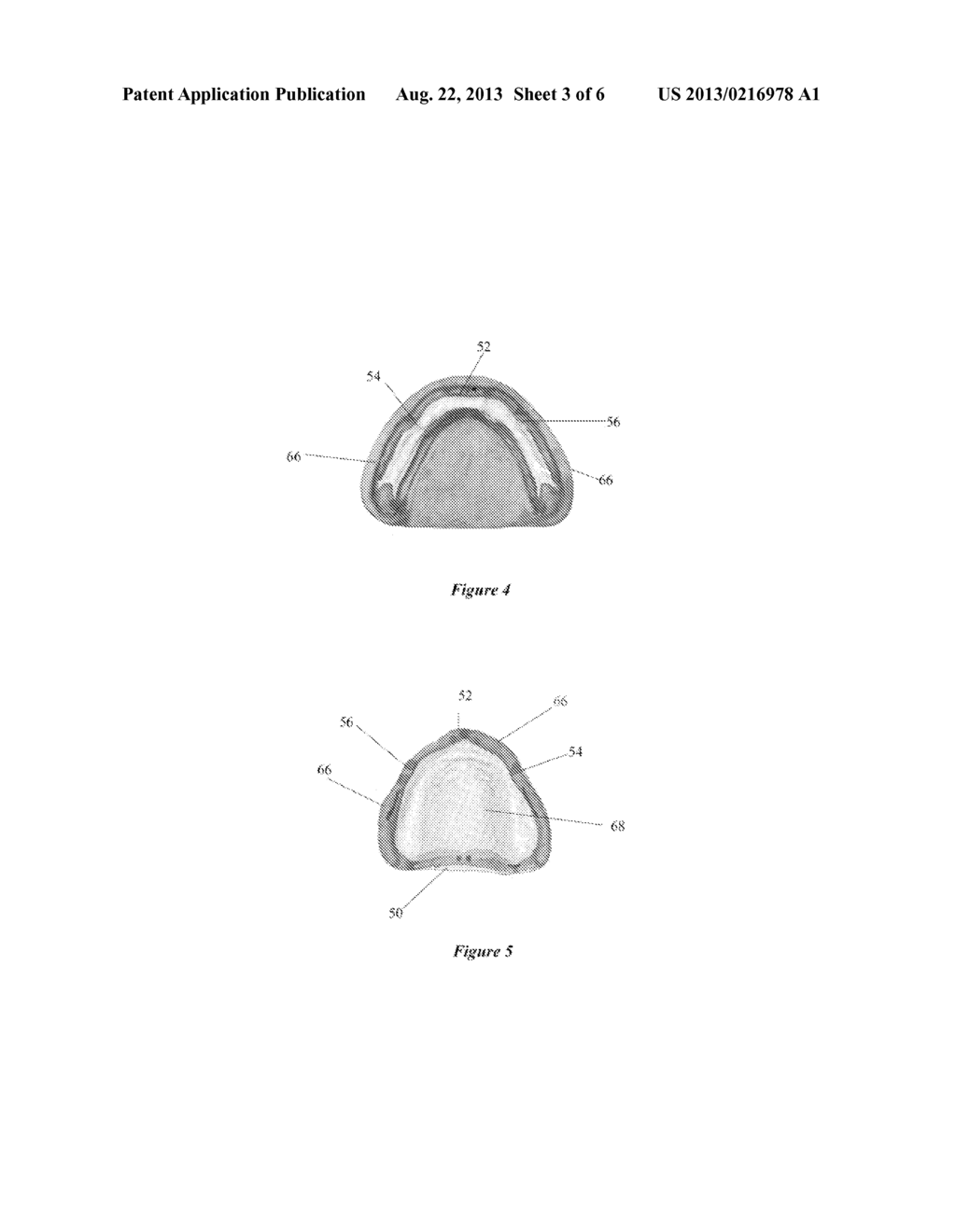 SYSTEMS AND PROCESS FOR FORMING ANATOMICAL FEATURES IN DENTURES - diagram, schematic, and image 04