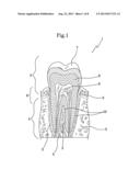 METHOD FOR DENTAL PULP CRYOPRESERVATION diagram and image