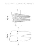 METHOD FOR DENTAL PULP CRYOPRESERVATION diagram and image