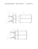 Garment for a Patient Undergoing Radiation Therapy or Other Uses diagram and image