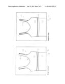 Garment for a Patient Undergoing Radiation Therapy or Other Uses diagram and image