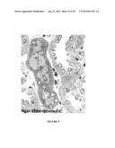 MUTANT NGAL PROTEINS AND USES THEREOF diagram and image