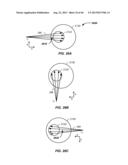 CHARGED PARTICLE TREATMENT, RAPID PATIENT POSITIONING APPARATUS AND METHOD     OF USE THEREOF diagram and image