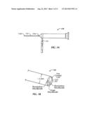 OPHTHALMIC ORBITAL SURGERY APPARATUS AND METHOD AND IMAGE-GUIDED     NAVIGATION SYSTEM diagram and image