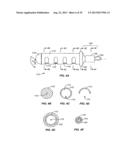 Minimally Invasive Lung Volume Reduction Devices, Methods, and Systems diagram and image