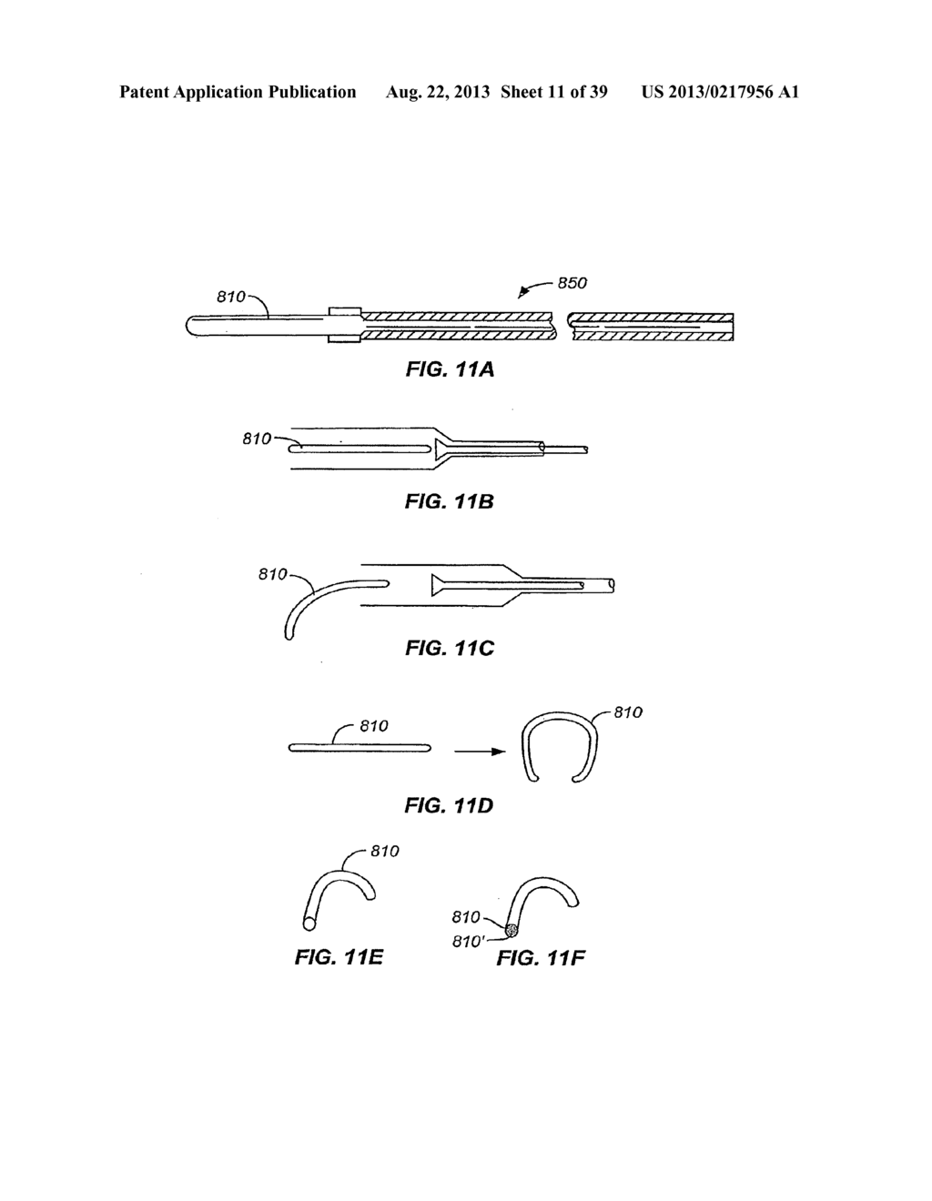 Minimally Invasive Lung Volume Reduction Devices, Methods, and Systems - diagram, schematic, and image 12