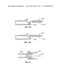 Minimally Invasive Lung Volume Reduction Devices, Methods, and Systems diagram and image