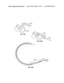 Minimally Invasive Lung Volume Reduction Devices, Methods, and Systems diagram and image