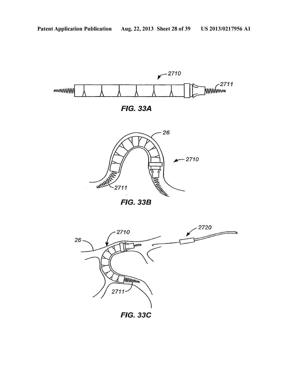 Minimally Invasive Lung Volume Reduction Devices, Methods, and Systems - diagram, schematic, and image 29