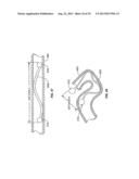 Minimally Invasive Lung Volume Reduction Devices, Methods, and Systems diagram and image