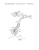 Minimally Invasive Lung Volume Reduction Devices, Methods, and Systems diagram and image