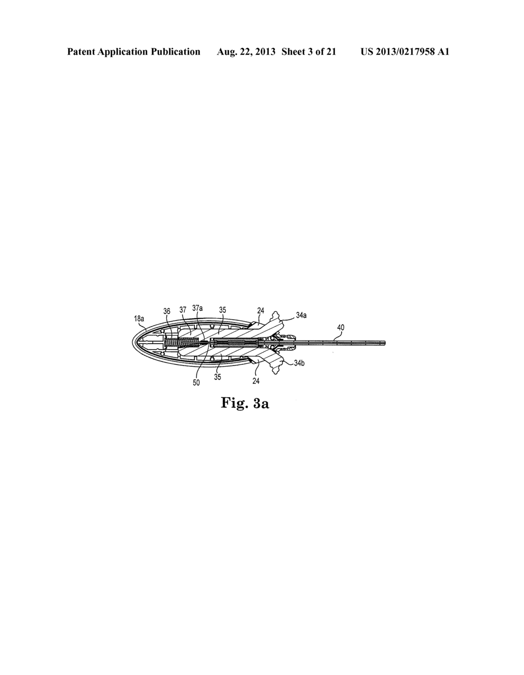 Surgical Needle Device - diagram, schematic, and image 04