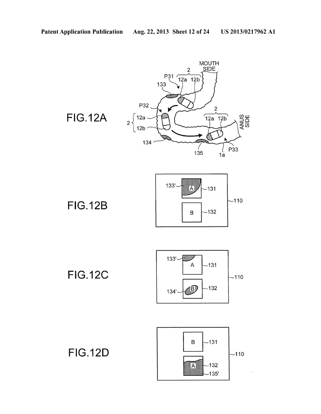 CAPSULE ENDOSCOPE SYSTEM, OPERATING METHOD OF IMAGE DISPLAY, AND     COMPUTER-READABLE RECORDING MEDIUM - diagram, schematic, and image 13