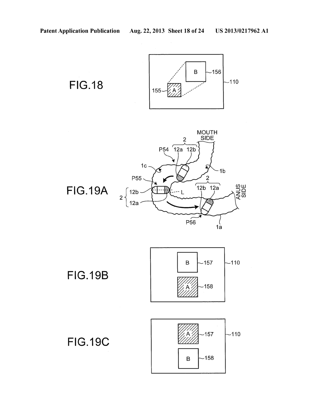 CAPSULE ENDOSCOPE SYSTEM, OPERATING METHOD OF IMAGE DISPLAY, AND     COMPUTER-READABLE RECORDING MEDIUM - diagram, schematic, and image 19