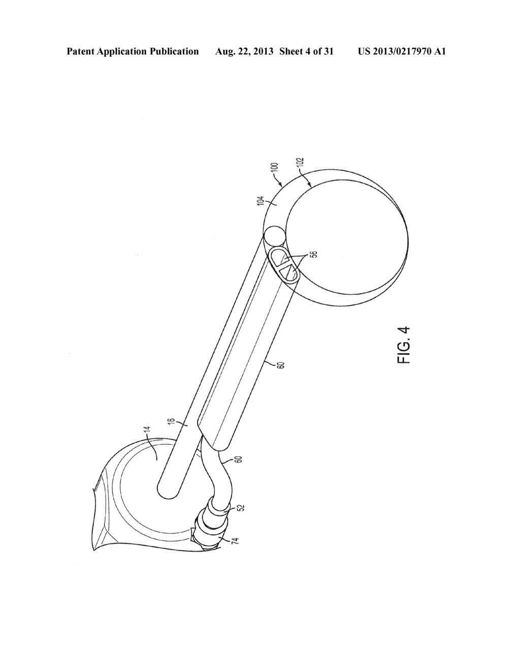 APPARATUS AND METHODS FOR CLEANING THE LENS OF AN ENDOSCOPE - diagram, schematic, and image 05