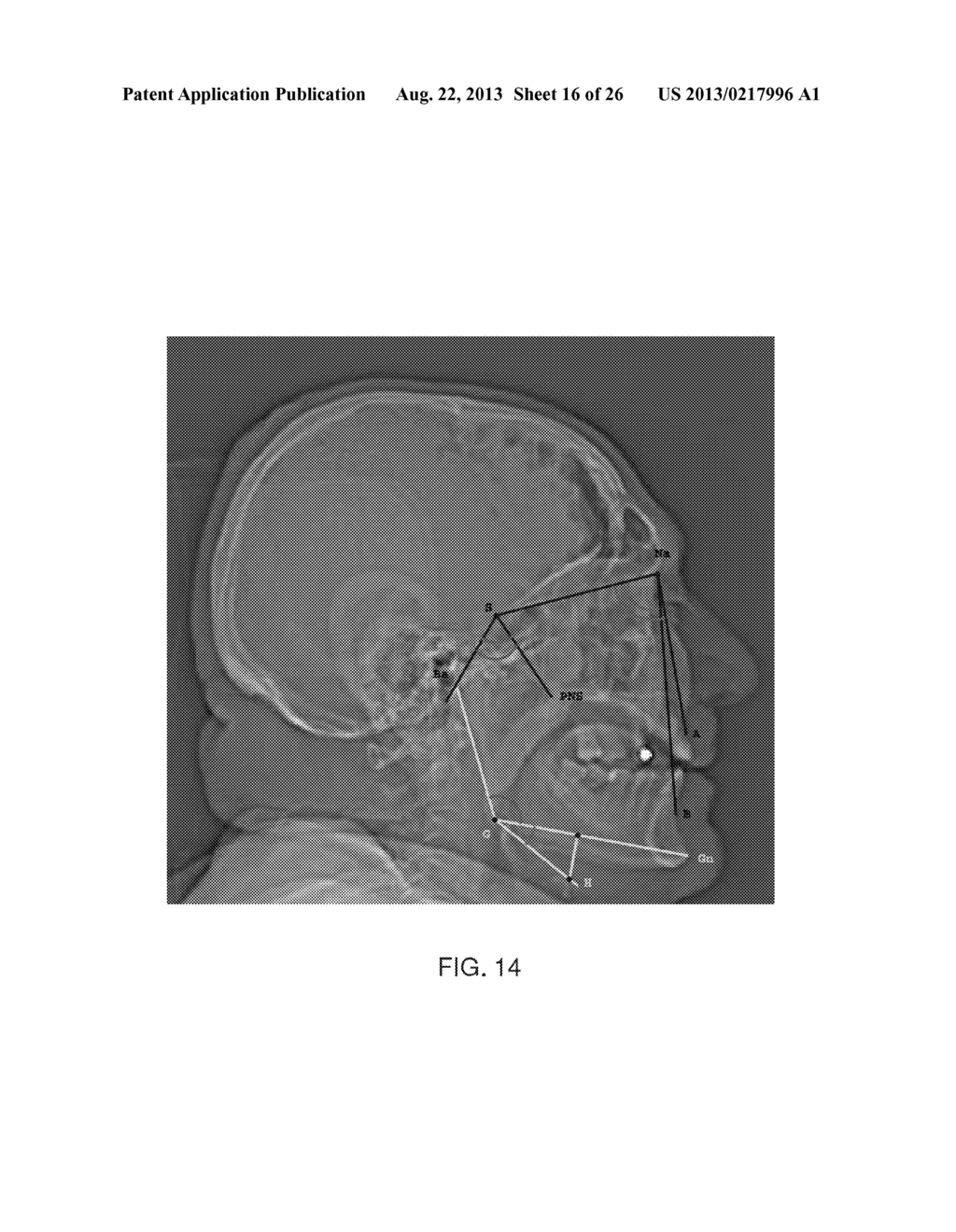 METHOD AND SYSTEM FOR ANALYZING IMAGES - diagram, schematic, and image 17