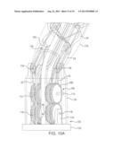 MINIMALLY INVASIVE NEUROSURGICAL INTRACRANIAL ROBOT SYSTEM AND METHOD diagram and image