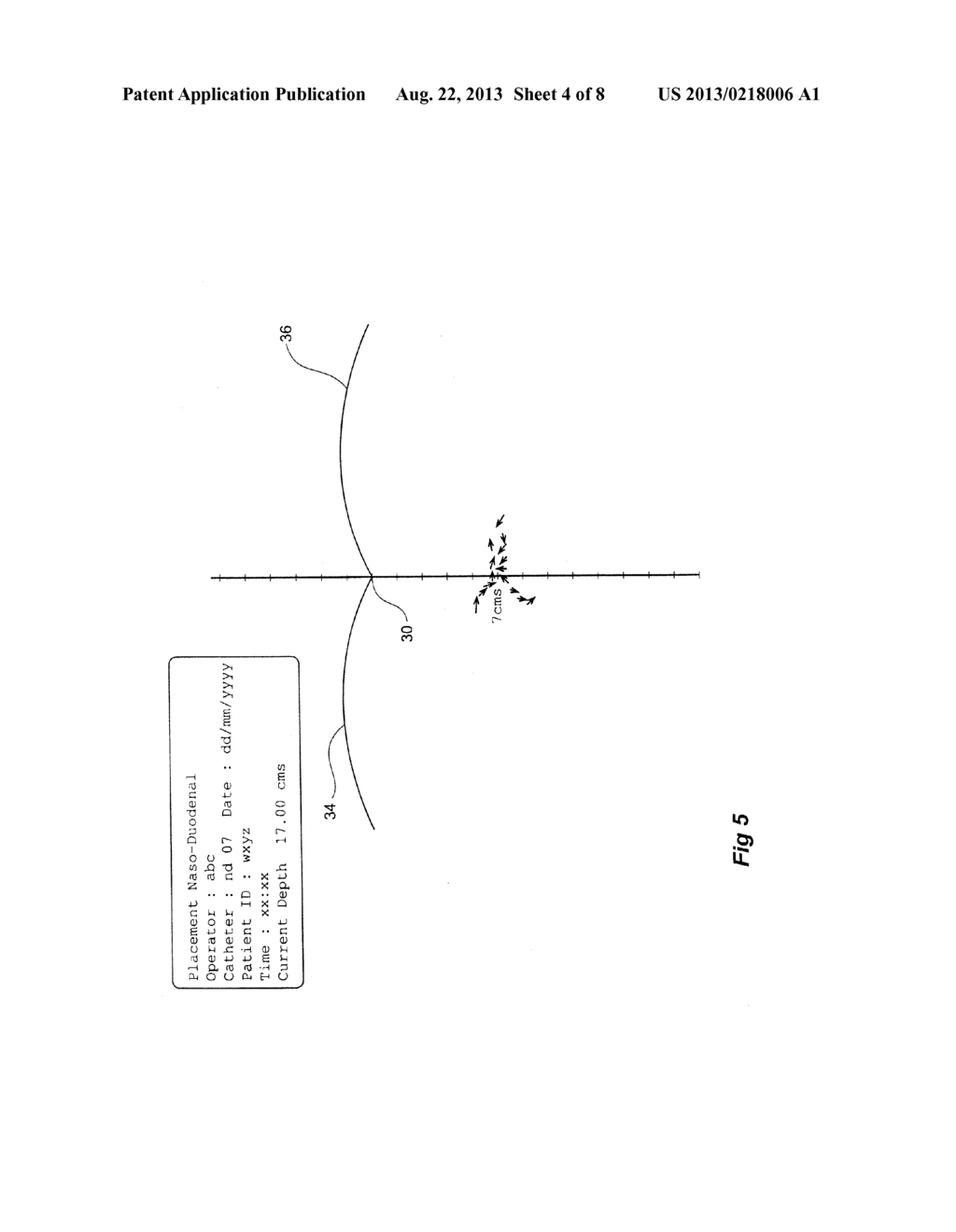 CATHETER LOCATOR APPARATUS AND METHOD OF USE - diagram, schematic, and image 05