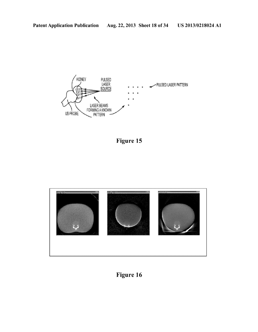 Interventional In-Situ Image-Guidance by Fusing Ultrasound and Video - diagram, schematic, and image 19