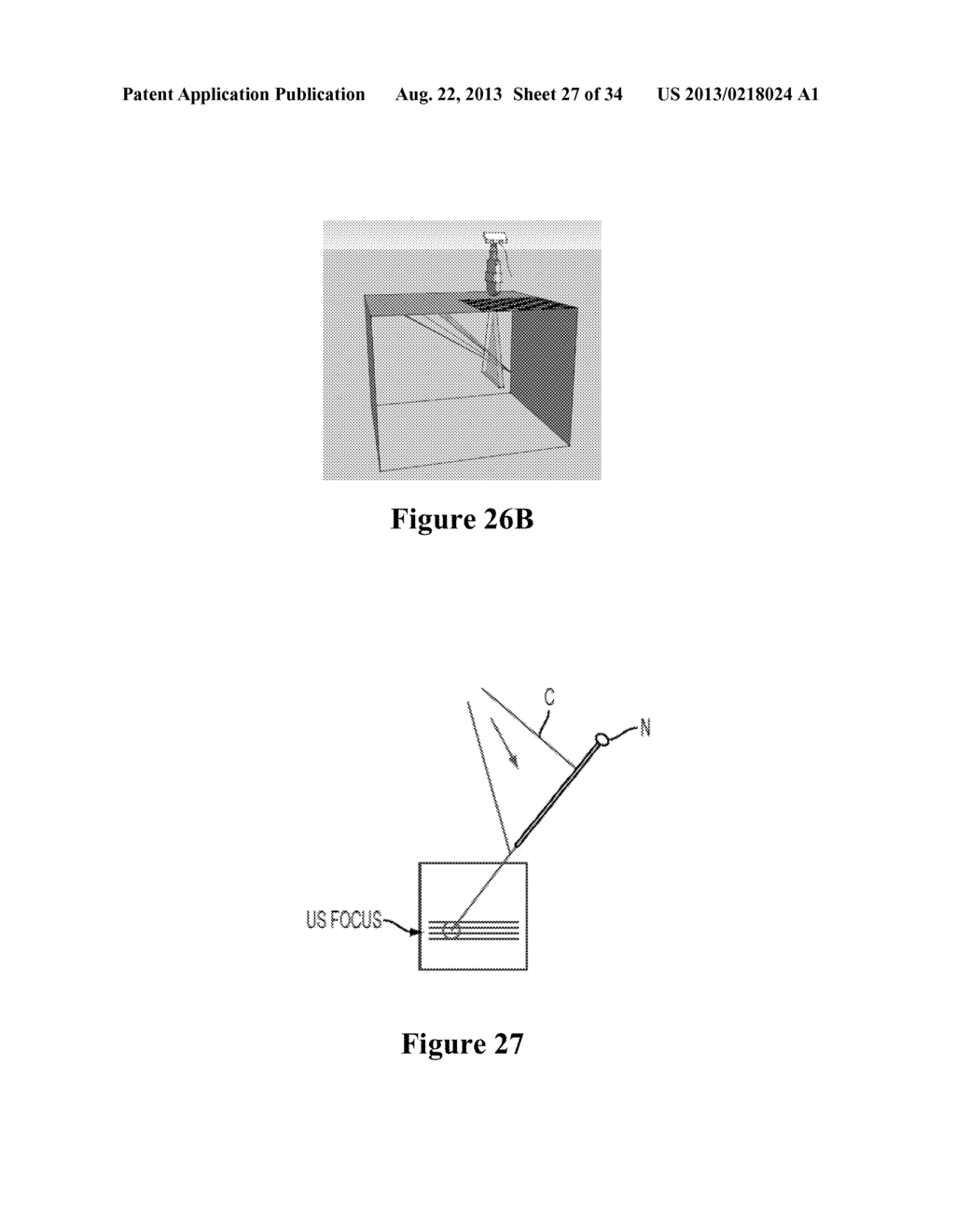 Interventional In-Situ Image-Guidance by Fusing Ultrasound and Video - diagram, schematic, and image 28