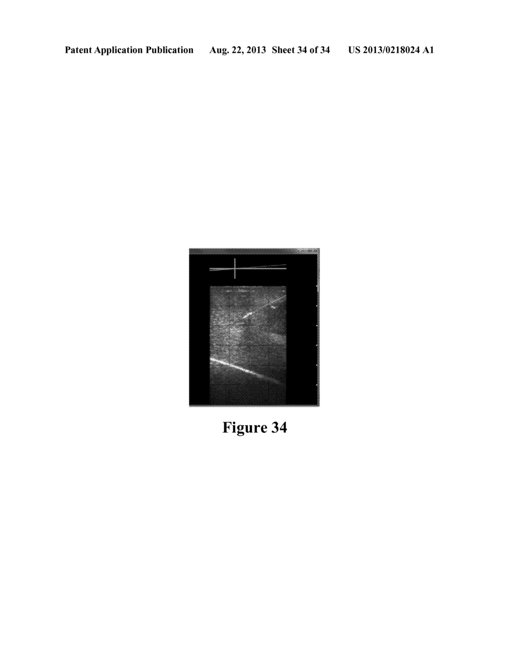 Interventional In-Situ Image-Guidance by Fusing Ultrasound and Video - diagram, schematic, and image 35