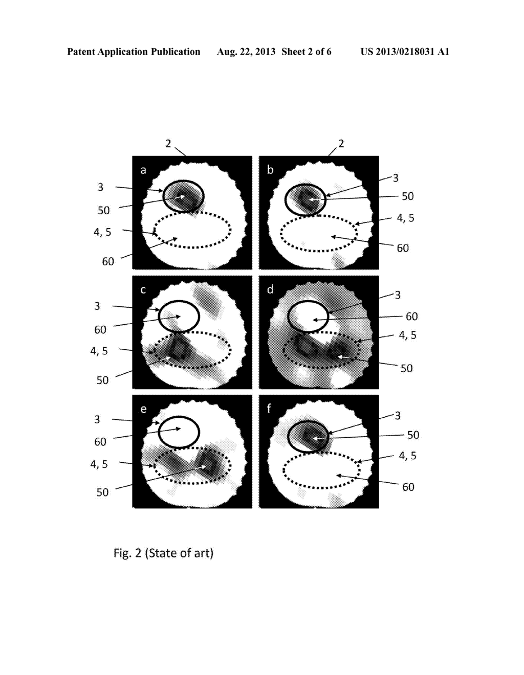 METHOD AND APPARATUS FOR ESTIMATING A PULSE ARRIVAL TIME VALUE - diagram, schematic, and image 03