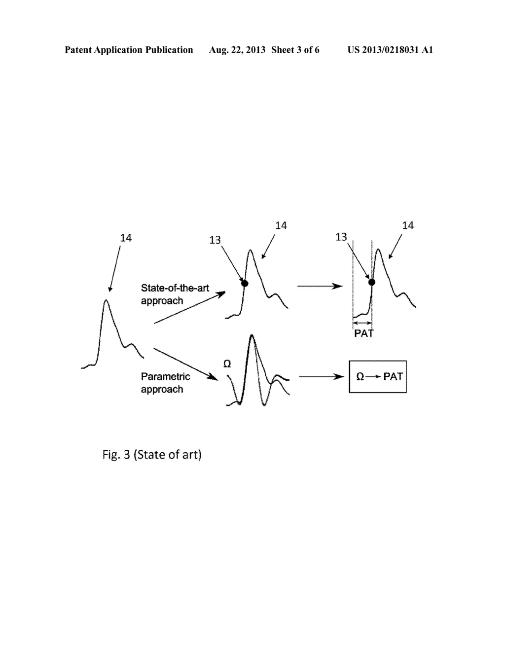 METHOD AND APPARATUS FOR ESTIMATING A PULSE ARRIVAL TIME VALUE - diagram, schematic, and image 04