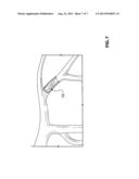 GUIDEWIRE WITH INTERNAL PRESSURE SENSOR diagram and image