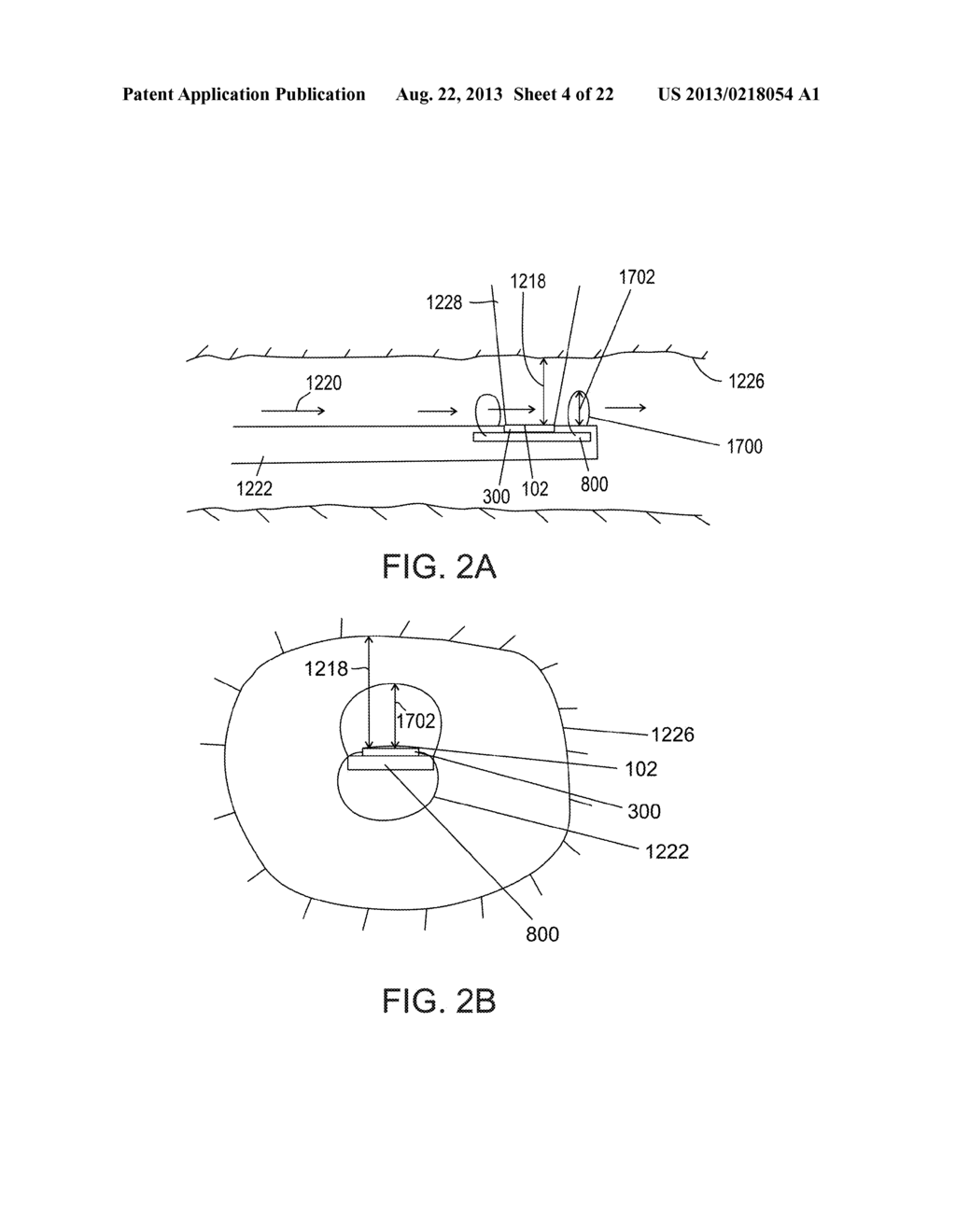 SEPARATION DEVICE FOR ULTRASOUND ELEMENT - diagram, schematic, and image 05