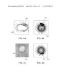 SEPARATION DEVICE FOR ULTRASOUND ELEMENT diagram and image