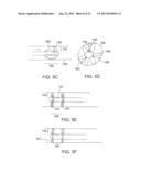 SEPARATION DEVICE FOR ULTRASOUND ELEMENT diagram and image