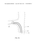 SEPARATION DEVICE FOR ULTRASOUND ELEMENT diagram and image