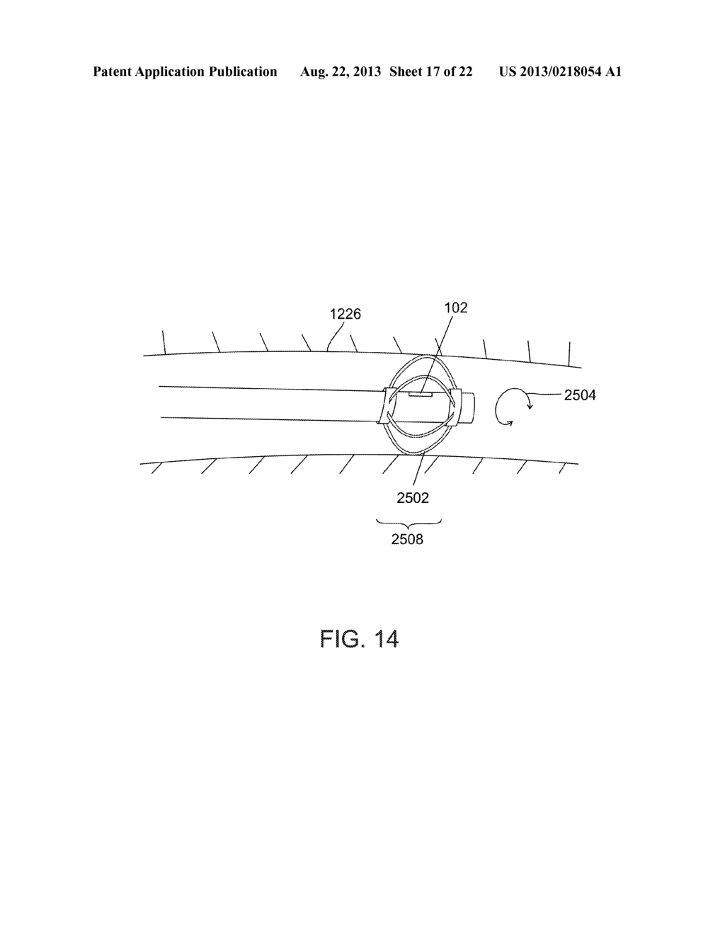 SEPARATION DEVICE FOR ULTRASOUND ELEMENT - diagram, schematic, and image 18