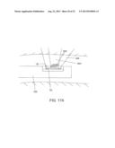 SEPARATION DEVICE FOR ULTRASOUND ELEMENT diagram and image