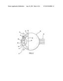 Pharmaceutical Delivery Device and Method for Providing Ocular Treatment diagram and image